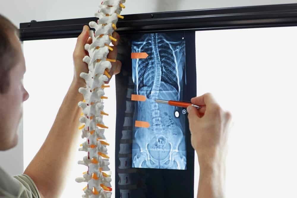 Doctor looking at xray of spine