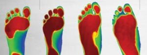 Infra Red pictures of feet
