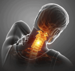 Neck Pain – Where Does It Come From